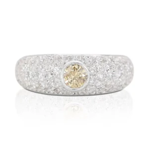 white gold ring